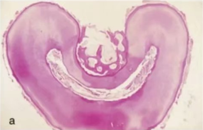 宇森SC-Pro鎳鈦根管銼|宇森醫(yī)療根管治療器械領(lǐng)跑者 宇森SC-Pro鎳鈦根管銼|宇森醫(yī)療根管治療器械領(lǐng)跑者