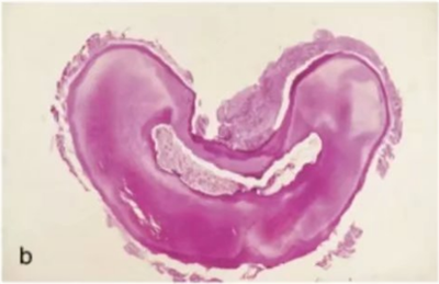 宇森SC-Pro鎳鈦根管銼|宇森醫(yī)療根管治療器械領(lǐng)跑者 宇森SC-Pro鎳鈦根管銼|宇森醫(yī)療根管治療器械領(lǐng)跑者