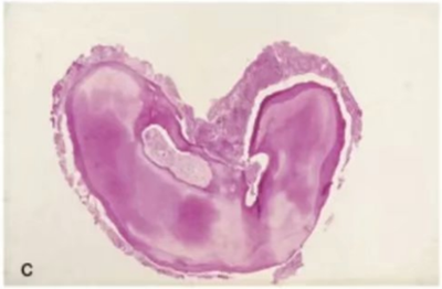 宇森SC-Pro鎳鈦根管銼|宇森醫(yī)療根管治療器械領(lǐng)跑者 宇森SC-Pro鎳鈦根管銼|宇森醫(yī)療根管治療器械領(lǐng)跑者