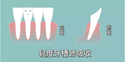 正畸矯正 正畸矯正