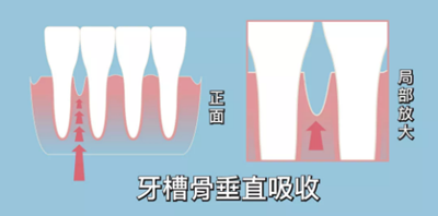 正畸矯正 正畸矯正