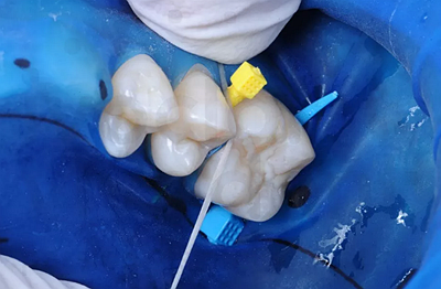 樹脂知識 樹脂知識