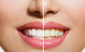 臨床工作中，總會有病人因聽信了謠言而延誤最佳治療時機，花了大錢還影響生活質(zhì)量。