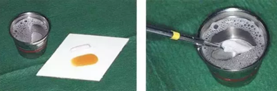 【牙周外科的基本技術(shù)技能】術(shù)后管理 【牙周外科的基本技術(shù)技能】術(shù)后管理