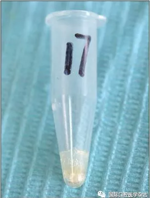 根管預(yù)備系統(tǒng) 根管預(yù)備系統(tǒng)