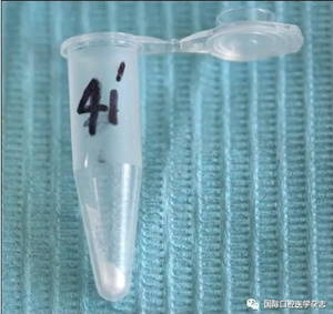 根管預(yù)備系統(tǒng) 根管預(yù)備系統(tǒng)