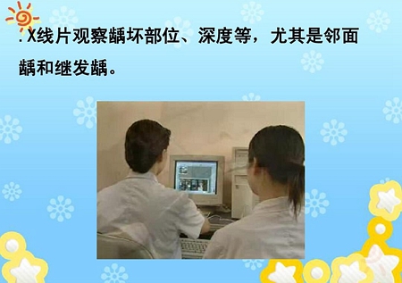 齲病診斷和鑒別診斷 齲病診斷和鑒別診斷