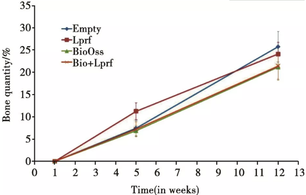 1`V[)@D20DAWIXF228W8$84.png 1`V[)@D20DAWIXF228W8$84.png