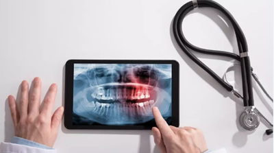 讓牙隱裂的診治少點(diǎn)「糾結(jié)」 讓牙隱裂的診治少點(diǎn)「糾結(jié)」