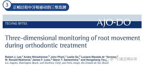 正畸文獻(xiàn)賞析--CBCT在正畸中的廣泛應(yīng)用 正畸文獻(xiàn)賞析--CBCT在正畸中的廣泛應(yīng)用