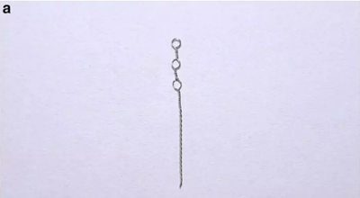 正畸文獻(xiàn)賞析--埋伏/阻生尖牙的正畸治療 正畸文獻(xiàn)賞析--埋伏/阻生尖牙的正畸治療