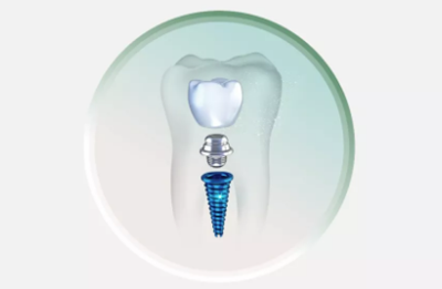 戰(zhàn)&ldquo;疫&rdquo;護(hù)牙方法：&ldquo;坐困家中&rdquo;，誰來救救我的種植牙？