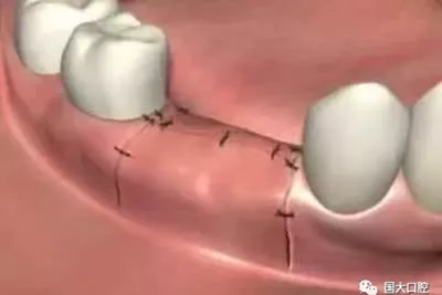 疫情期間，種植科突發(fā)狀況居家處理建議