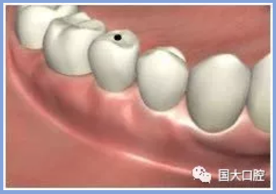 疫情期間，種植科突發(fā)狀況居家處理建議