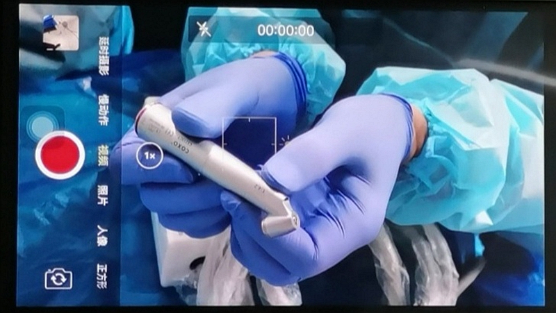 宇森電動馬達(dá)微創(chuàng)拔牙 宇森電動馬達(dá)微創(chuàng)拔牙