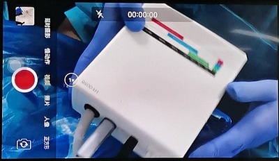 宇森電動馬達(dá)微創(chuàng)拔牙 宇森電動馬達(dá)微創(chuàng)拔牙