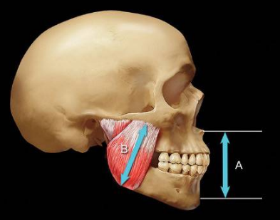 如何利用垂直距離解決好臨床問題 如何利用垂直距離解決好臨床問題
