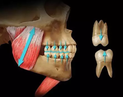 如何利用垂直距離解決好臨床問題 如何利用垂直距離解決好臨床問題
