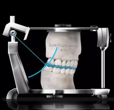 如何利用垂直距離解決好臨床問題 如何利用垂直距離解決好臨床問題