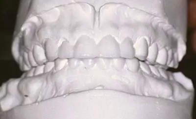 如何利用垂直距離解決好臨床問題 如何利用垂直距離解決好臨床問題