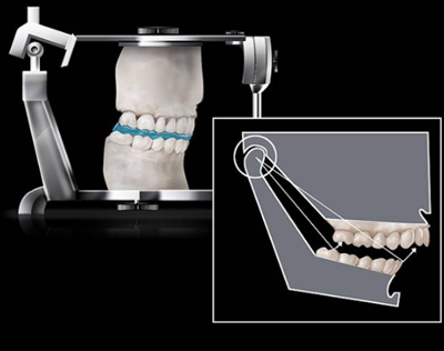 如何利用垂直距離解決好臨床問題 如何利用垂直距離解決好臨床問題
