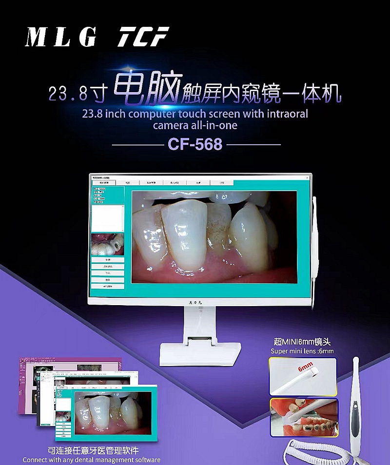 美力光內(nèi)窺鏡 美力光內(nèi)窺鏡