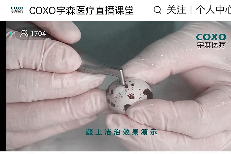 宇森口內(nèi)噴砂潔牙機CP-1新品發(fā)布 宇森口內(nèi)噴砂潔牙機CP-1新品發(fā)布