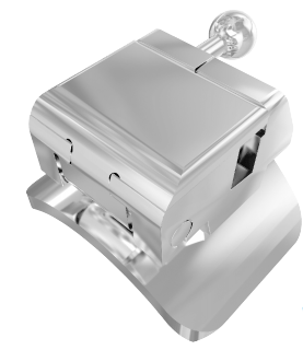 杰特全封閉型自鎖正畸托槽 杰特全封閉型自鎖正畸托槽