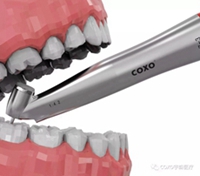 宇森45度拔牙手機 宇森45度拔牙手機